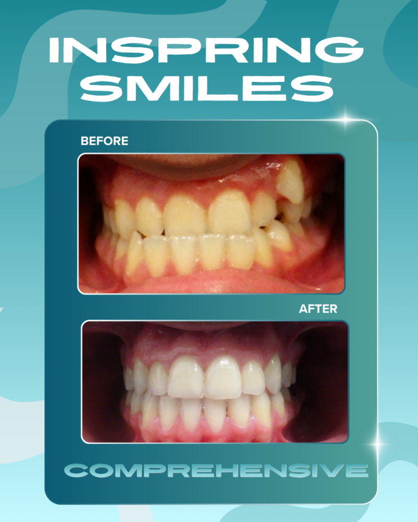 Smile Gallery