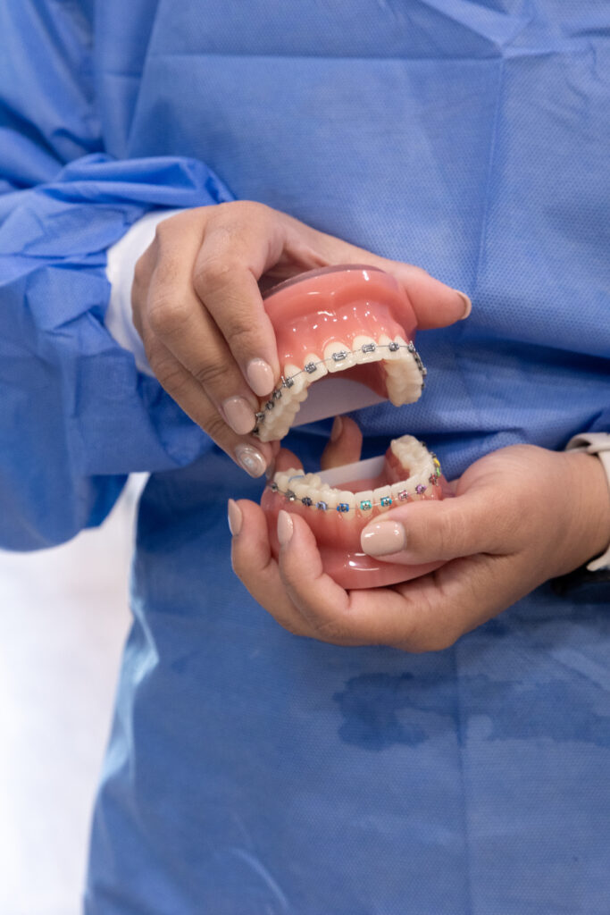Traditional Braces