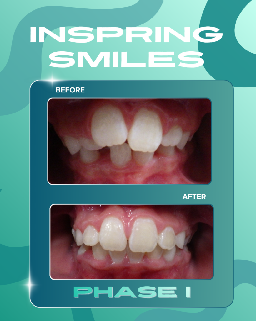 Smile Gallery