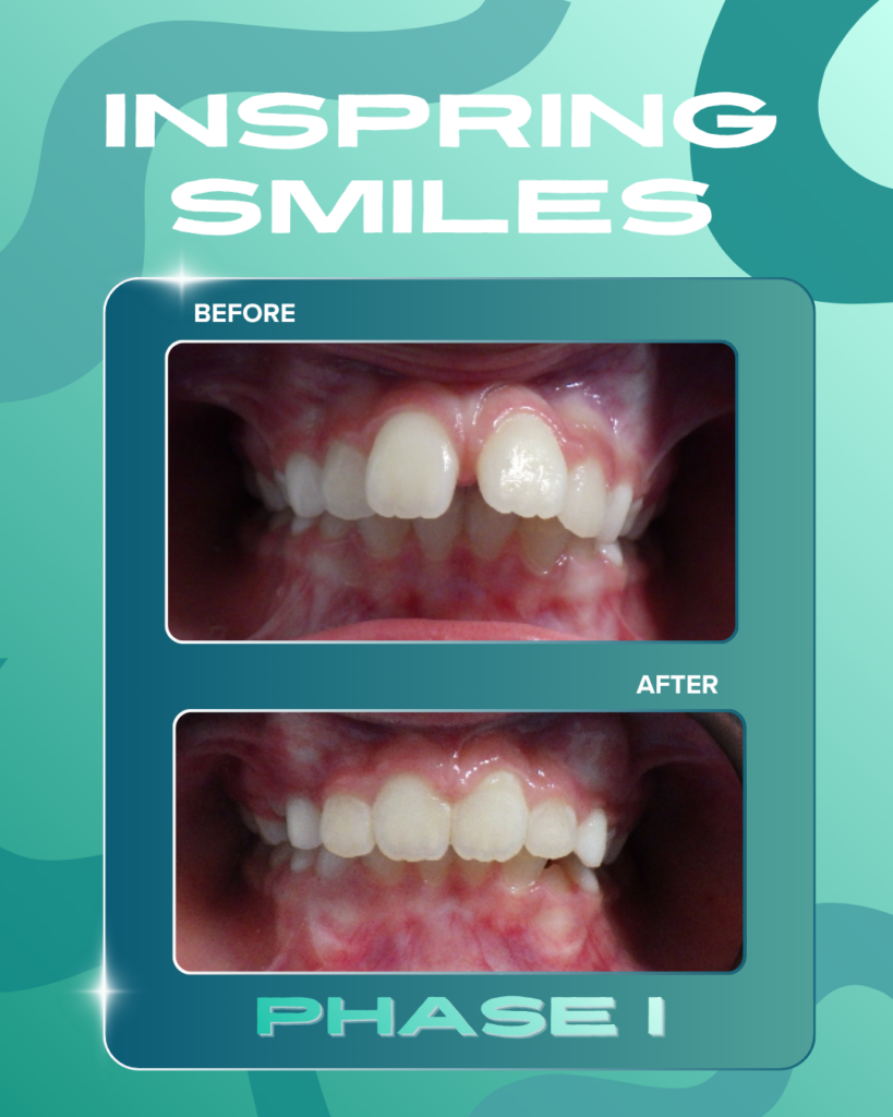 Smile Gallery