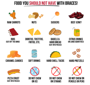 Dos and Donts. Foods for braces.
