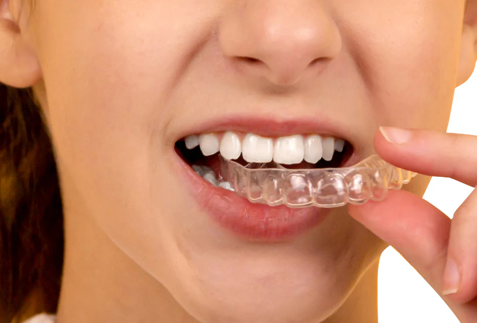 Retainers